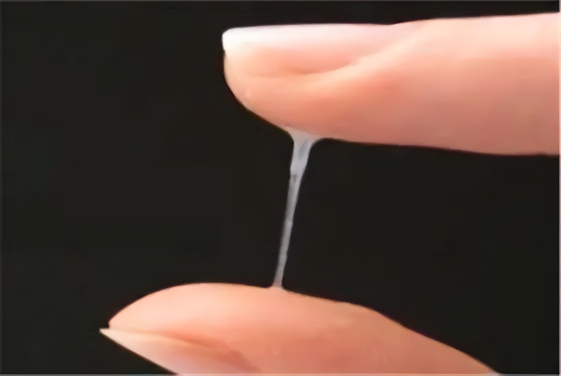 白带长这样90%是得了妇科病,白带呈黑色出现啥问题了