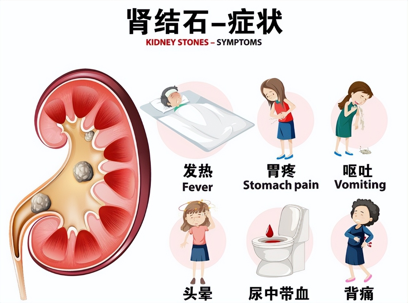 四川省人民医院治疗结石医生,四川结石病医院哪个医生好