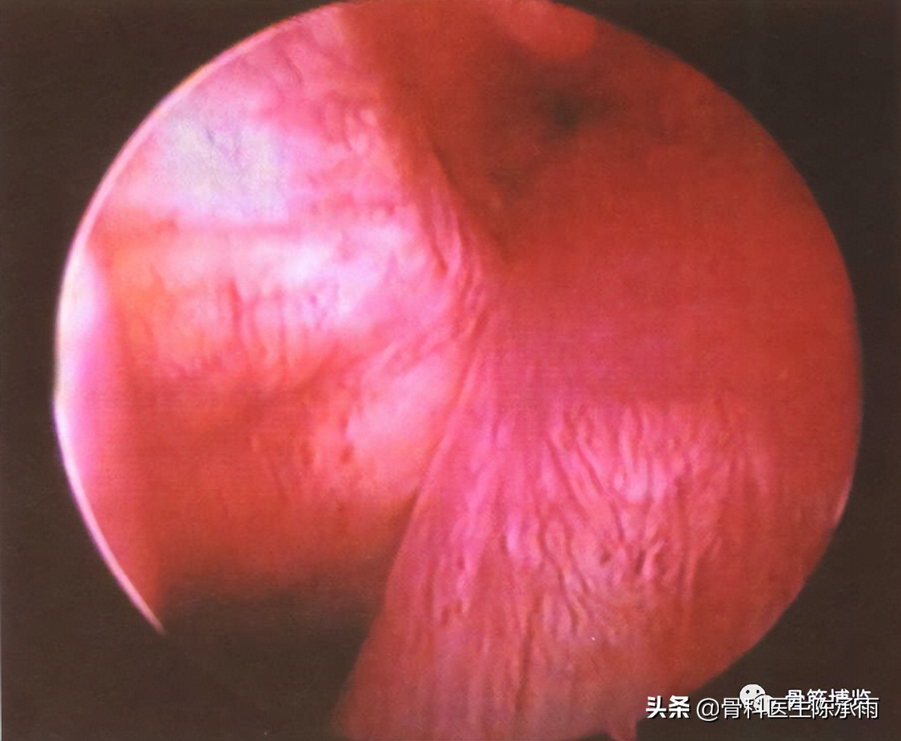 膝关节2度损伤需要做关节镜吗,膝关节常见损伤的检查方法