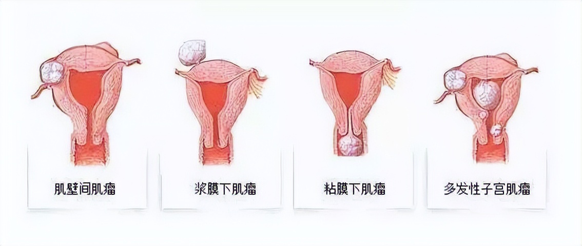 48岁女子头晕贫血，吃补品无效，医生看到牙龈：子宫可能需要切除