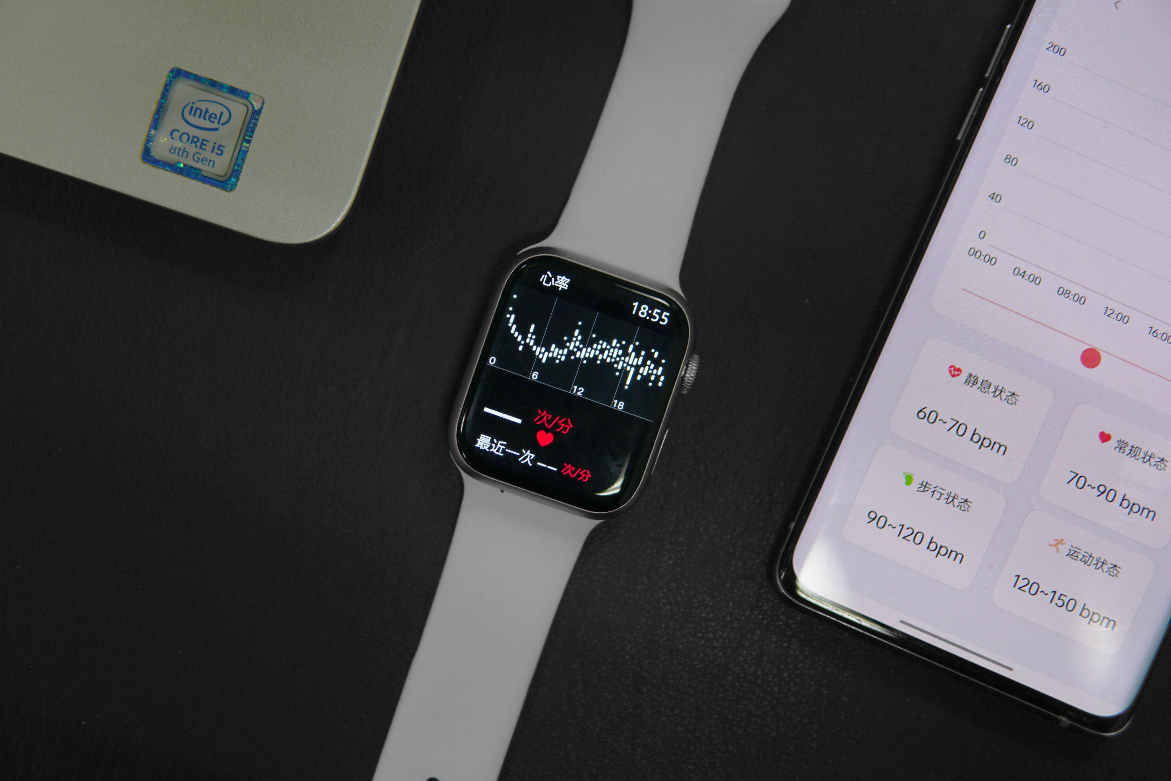 用268让你忘掉Apple Watch！微穿戴这品牌真敢玩，性价比到了极致