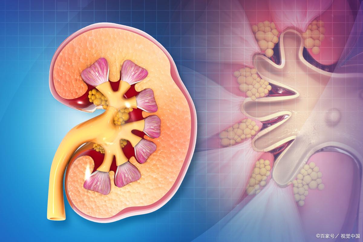临床诊断肾上腺良性肿瘤怎么办,体检时出现肾上腺肿瘤怎么办