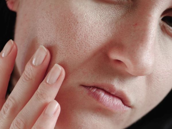 脸颊毛孔粗大毛孔发红,脸颊两侧毛孔粗大如何改善