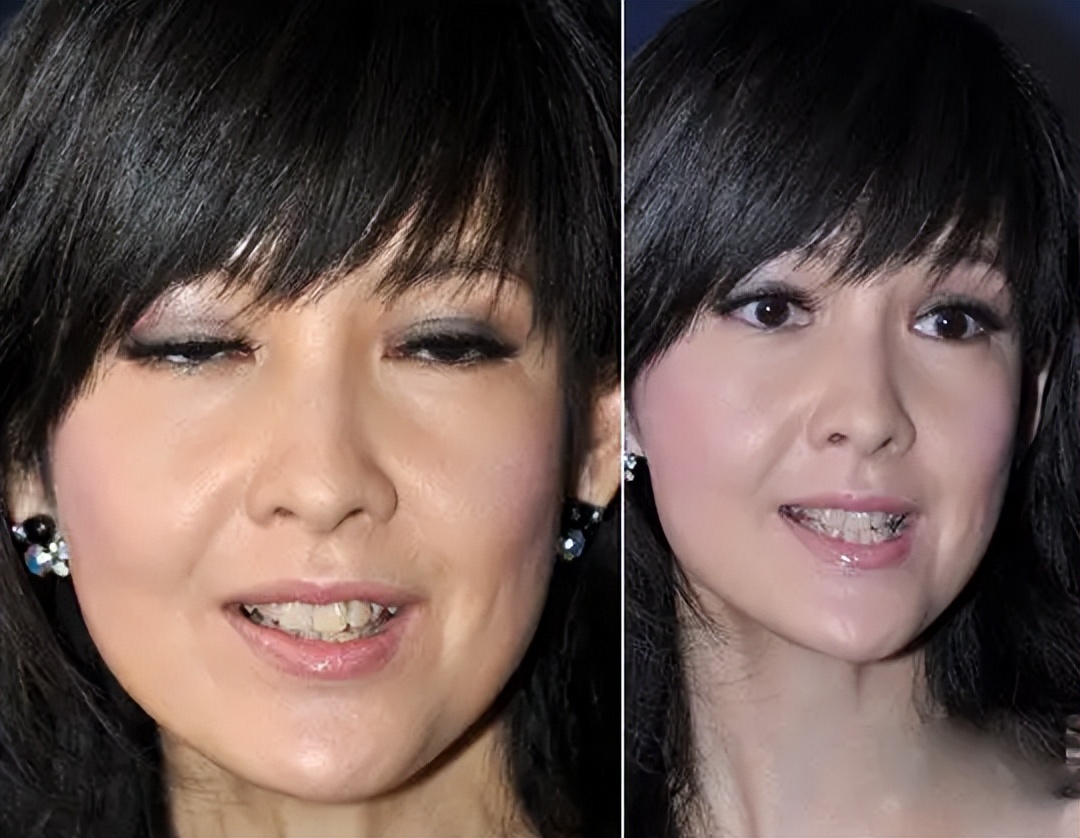 娱乐圈女星龅牙露一颗牙,娱乐圈的假牙女星