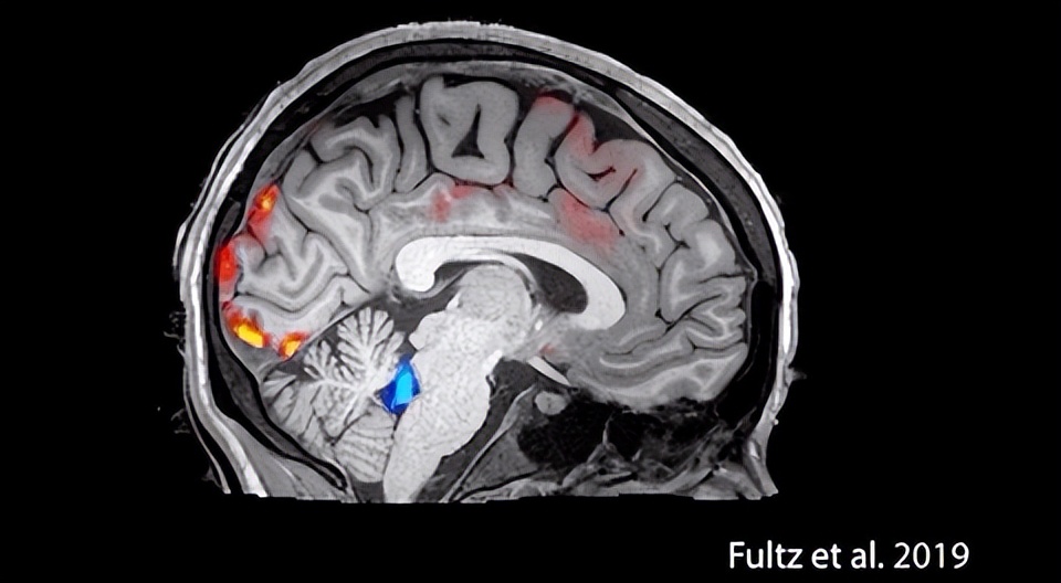 比熬夜更伤身体的10个表现,熬夜综合症变傻