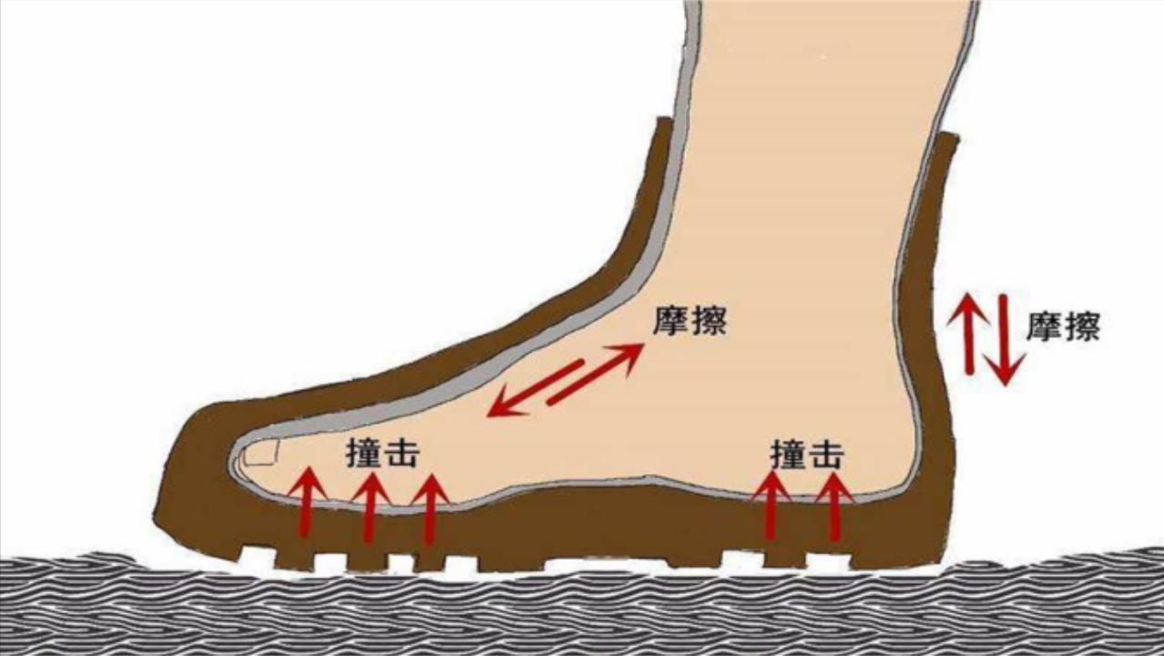 小孩脚底板磨出茧子走路特别疼,脚底板爱进风什么原因