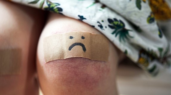 孩子碰伤了怎么祛疤痕,儿童凹陷性疤痕彻底修复方法