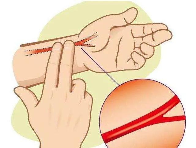 贞洁守宫砂鉴定方法,古代守宫砂判断法