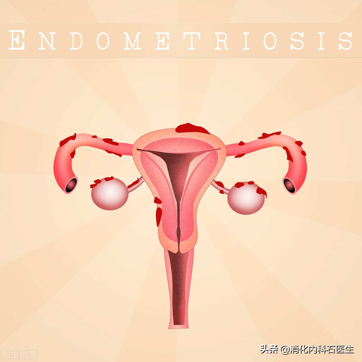 女子舌头脓肿做手术,女性舌肿物做完手术该怎么办