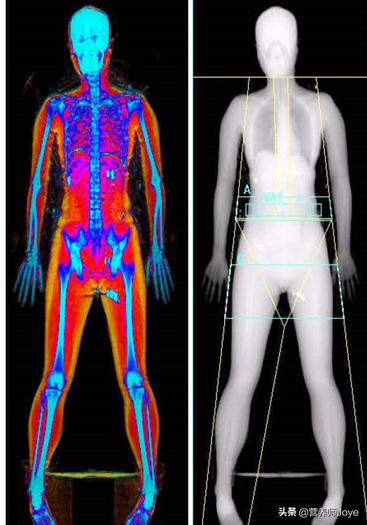 体脂秤不可信？到底什么体脂率才是你该有的样子？