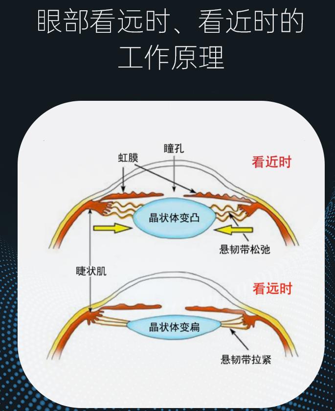 隐形眼镜区分正反,隐形眼镜专业知识测试