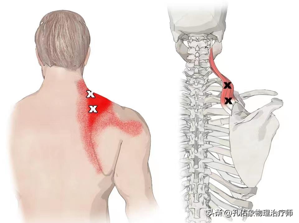 左边肩膀疼痛的治疗方法小妙招,肩膀手往后抬时疼痛是什么原因