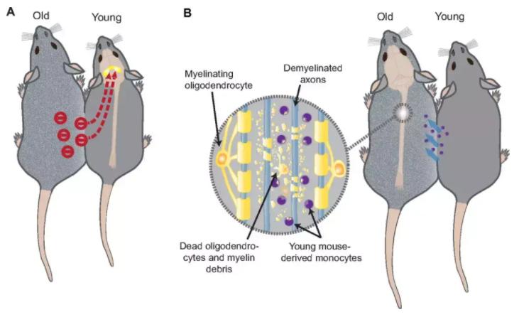 花5万输年轻人血液,就能“返老还童”?揭开美国换血疗法真面目