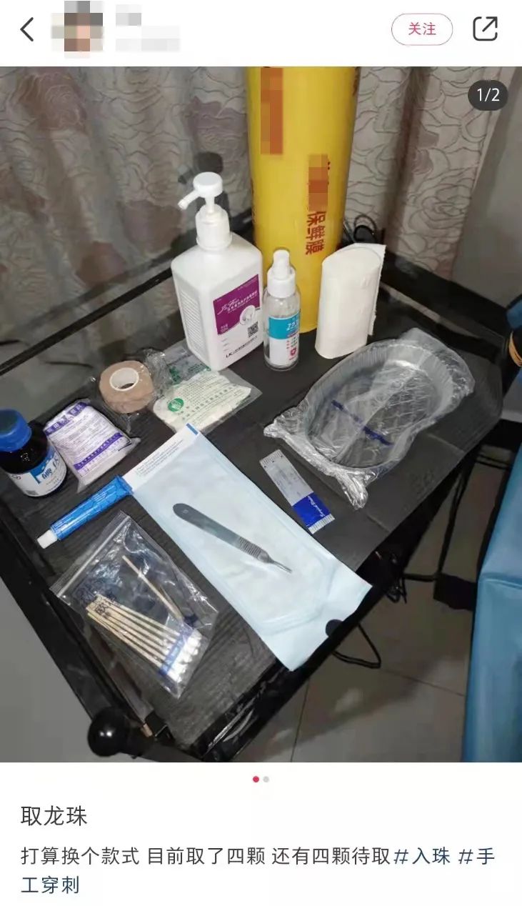 生殖器下面做埋线手术,生殖器埋线有什么危害