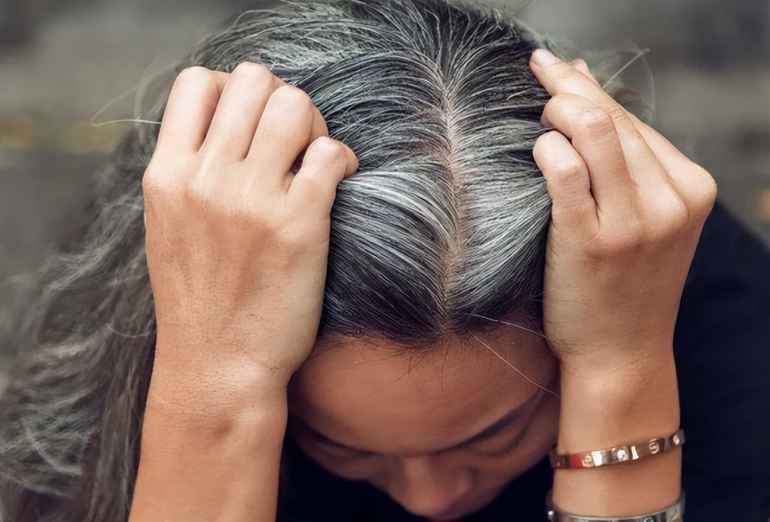 白头发越长越多到底是怎么回事,为什么白头发多了
