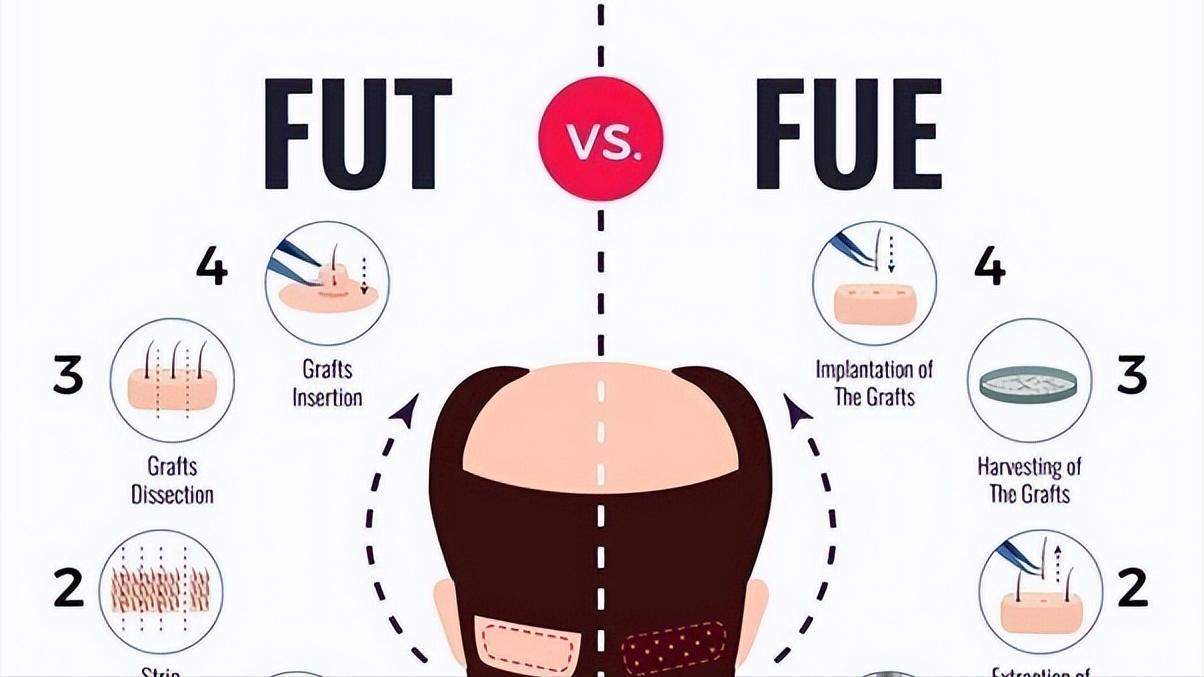 黑芝麻黑豆黑米可以让头发变黑吗,长白头发和肾虚有关系吗