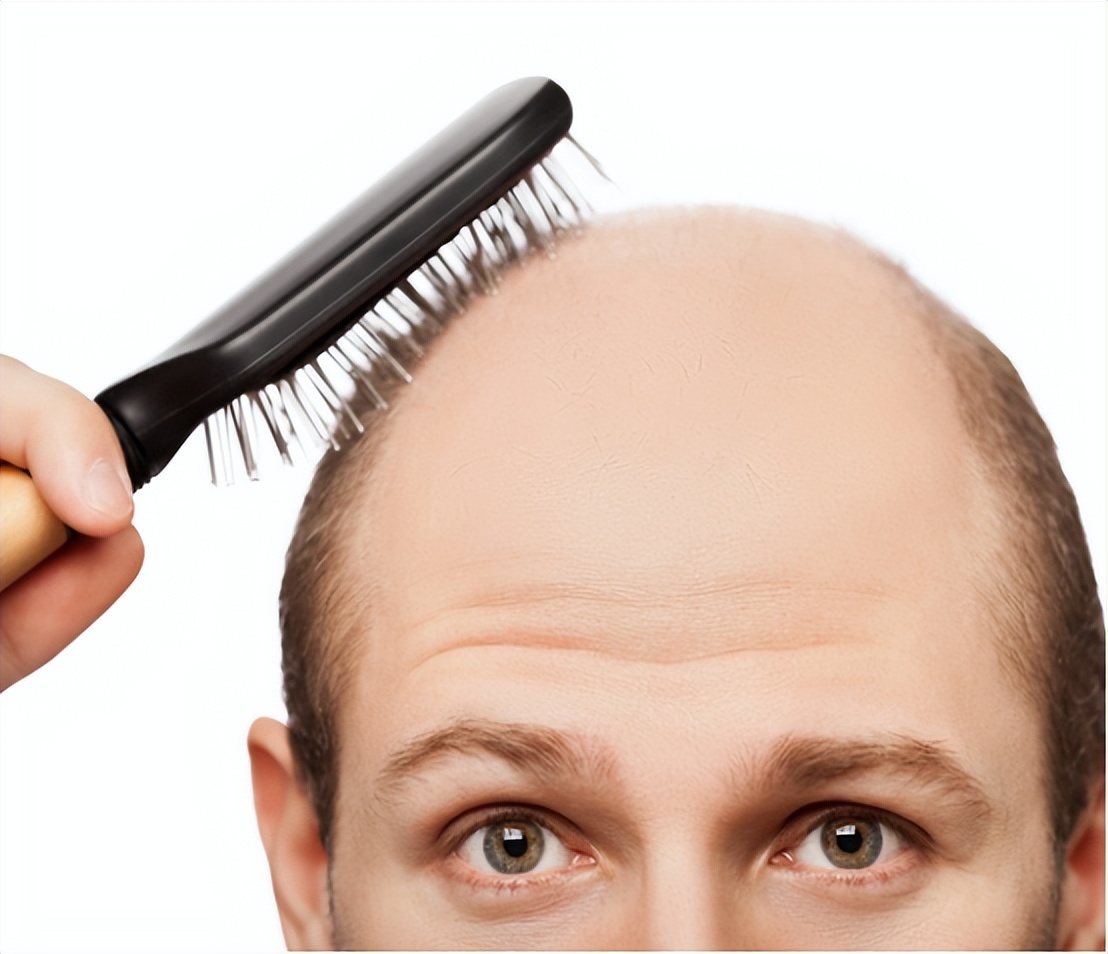 男性雄性激素越旺盛越好吗,男人50岁后雄性激素旺会脱发吗