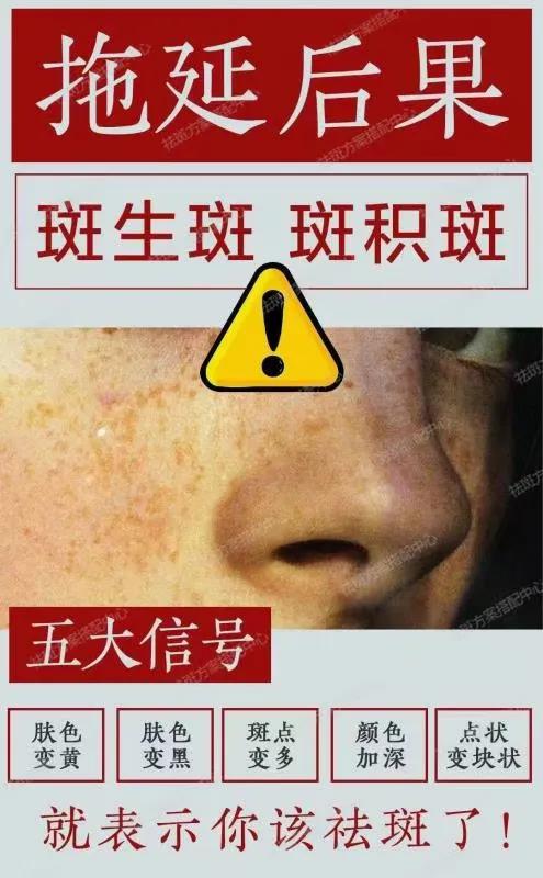 五天液氮冷冻祛斑亲身经历,千白氢醌乳膏祛斑亲身经历