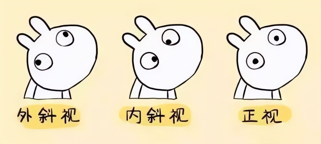 泪囊吻合手术和置管有啥区别,泪囊切除术是几类切口