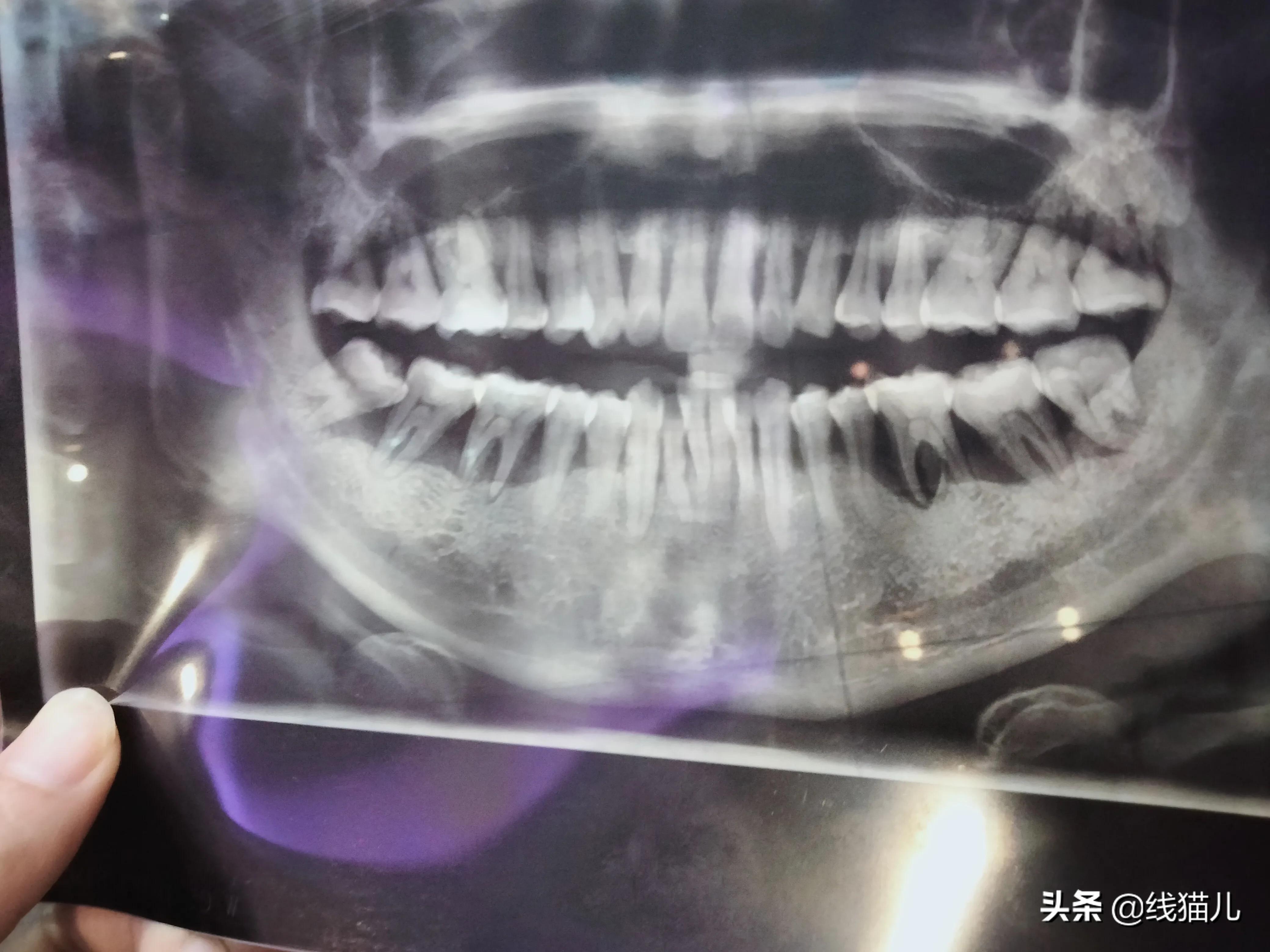 现在要做核酸检测才能去医院吗,现在去医院做核酸要预约吗