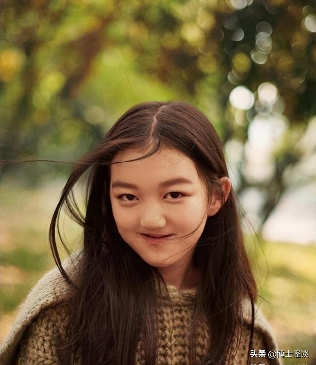 王菲女儿兔唇可以修复好吗,王菲女儿兔唇原来很严重吗