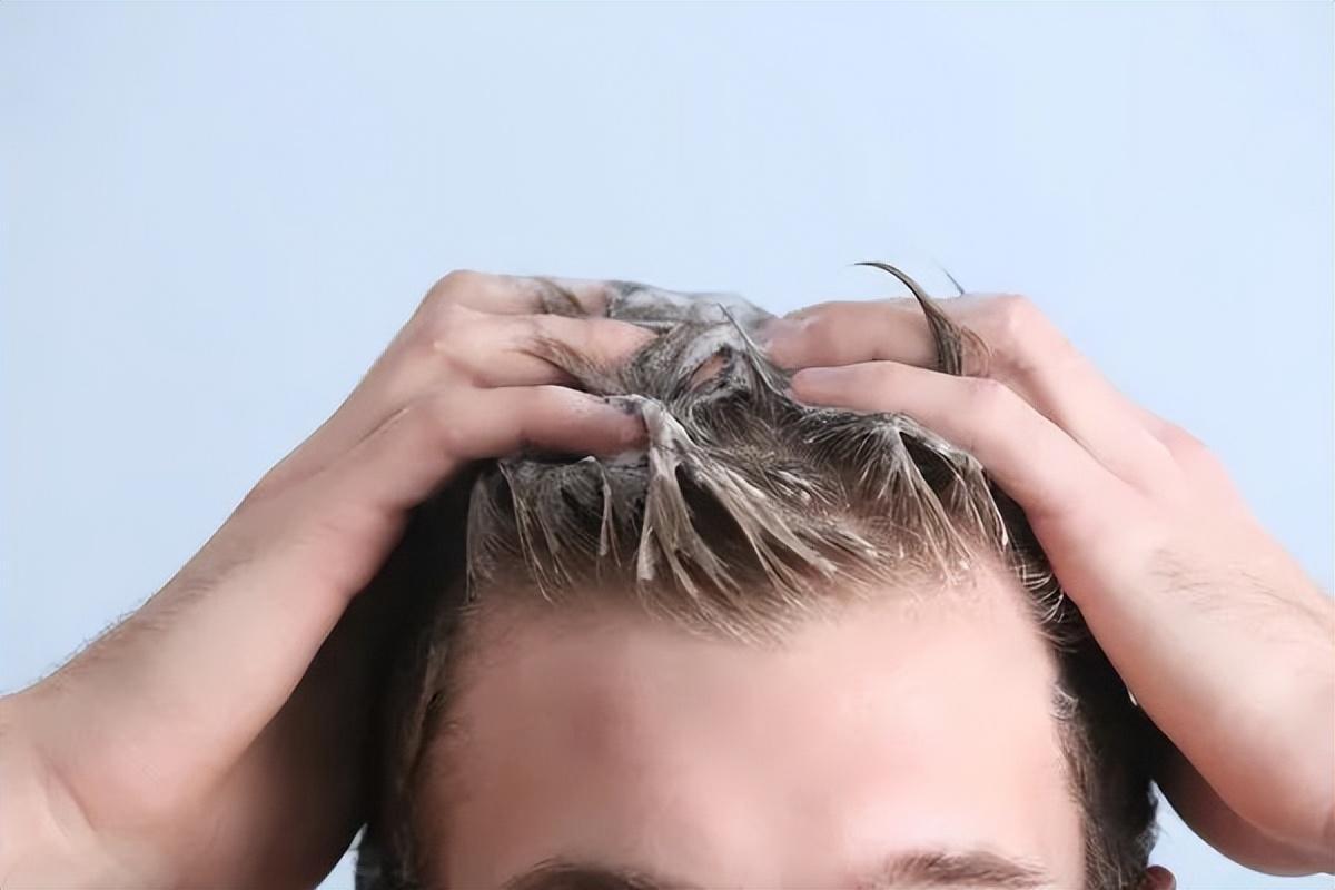 头痒头屑多掉发怎么办最快最有效,头屑多头皮痒脱发用什么产品