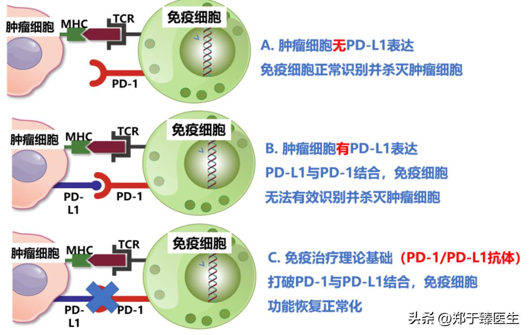 当癌症遇到新冠会怎么样,当癌症病人感染新冠病毒怎么办