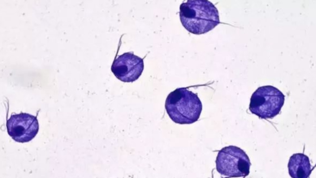 一瓶100毫升甲硝唑多少钱,几块钱的甲硝唑能有三种作用