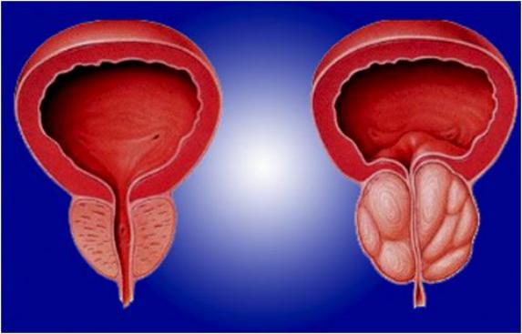 术后几年疼痛难忍怎么缓解,术后太痛怎么办
