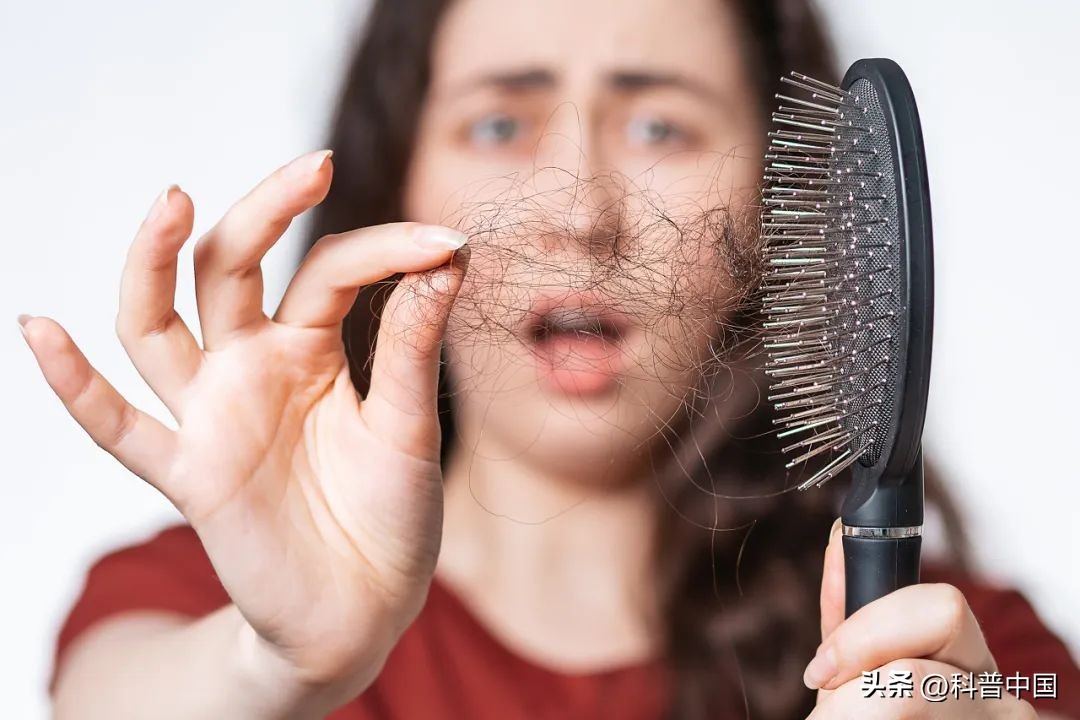 最近总是掉头发是怎么回事,老是掉头发是身体出现问题吗