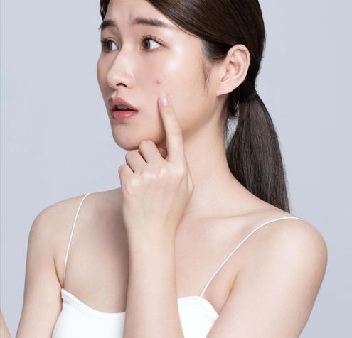 皮肤油腻易出油是身体哪出问题了,皮肤油腻易出油用什么护肤品