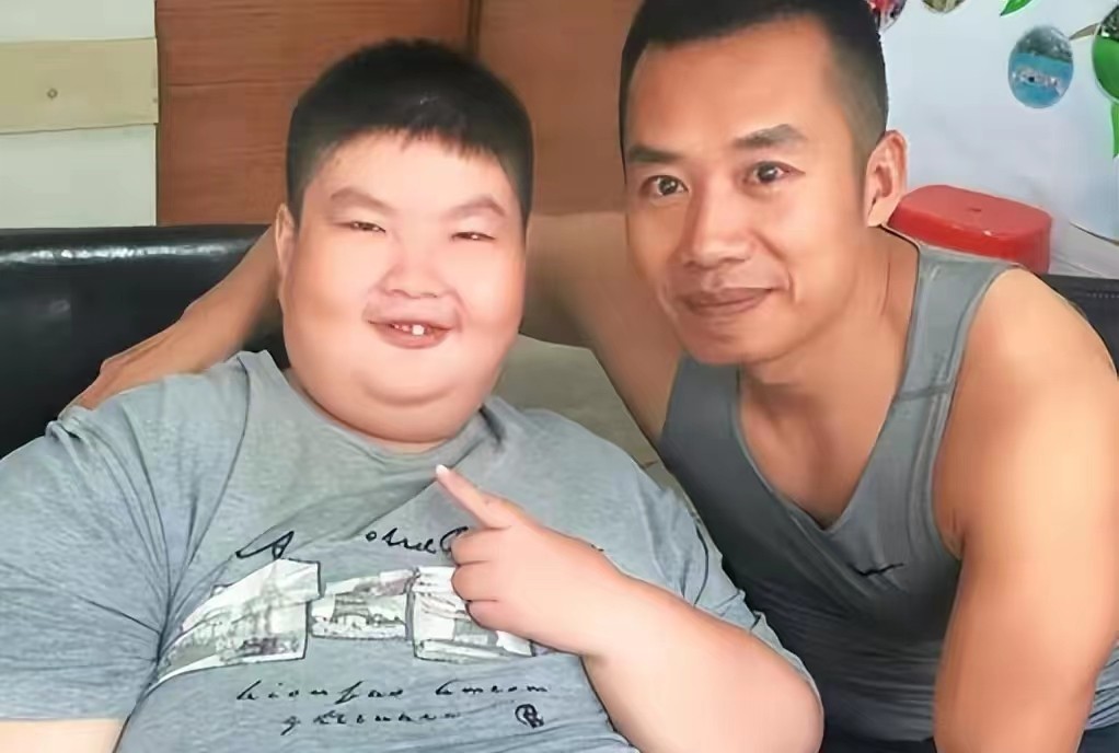 江西一男孩14岁达到300斤,10岁男孩一顿吃三碗体重飙到130斤