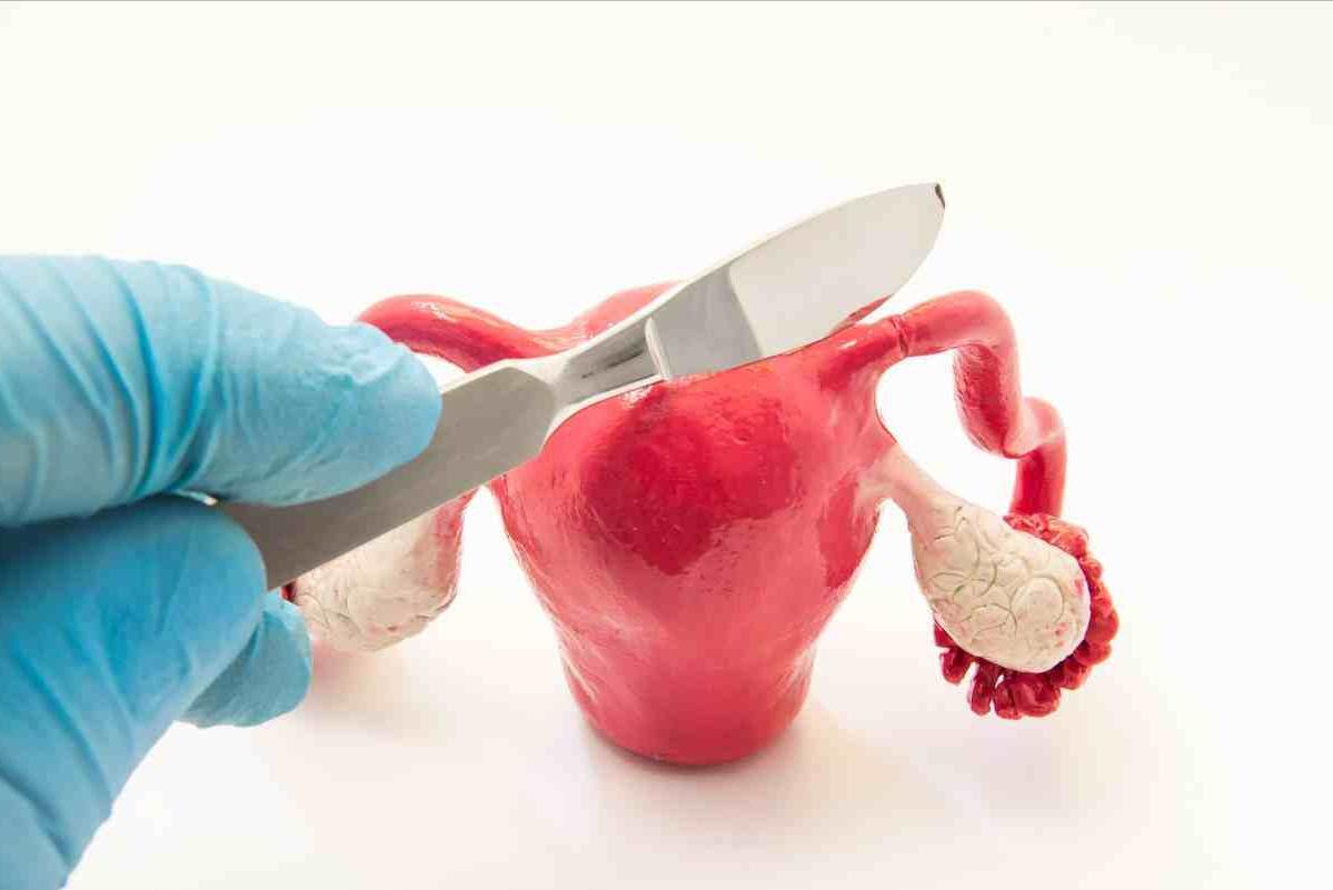 女性发生性出血是什么原因,女性出血是什么原因引起的