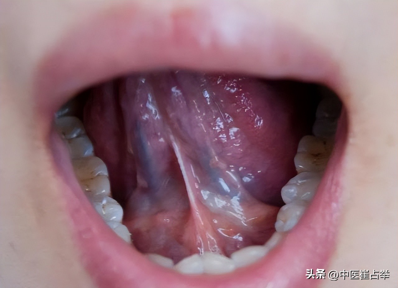 活血化瘀先温阳,温阳散寒活血化瘀的中成药