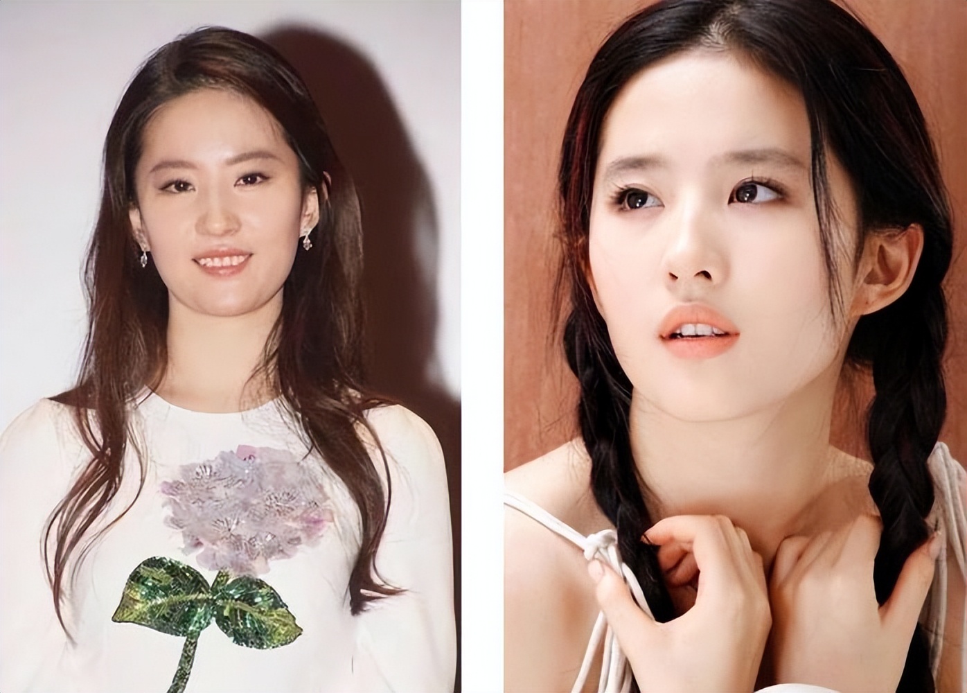 下巴填充教程图解,填充下巴大概多少钱