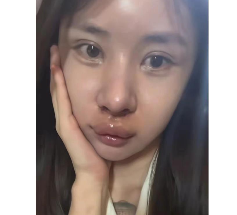 泰国手术变性网红,泰国做变性手术新闻