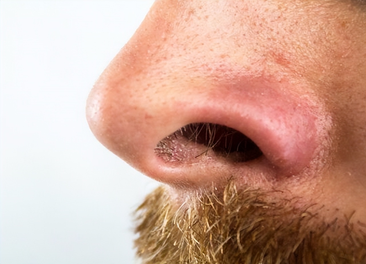鼻毛为什么会变白医生告诉你答案,男性头发胡子鼻毛变白是什么原因