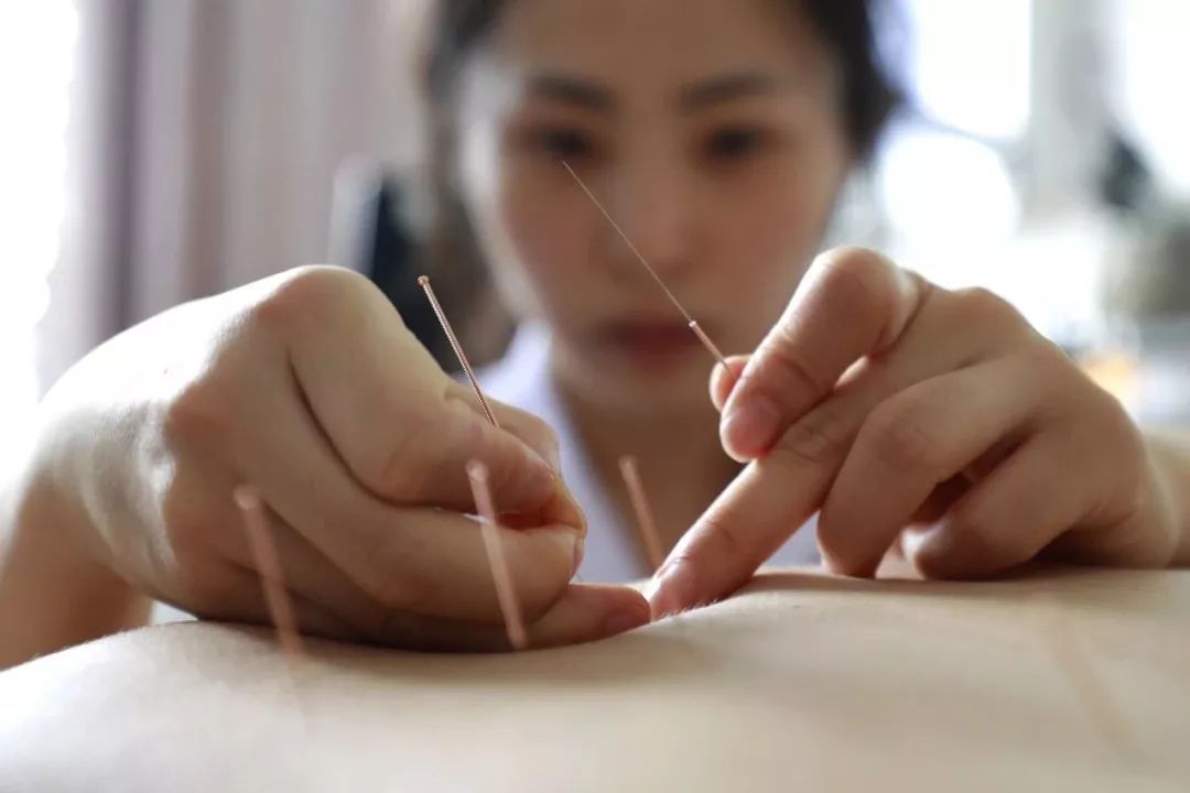 针灸临床经验选编精华,古法针灸临床治验