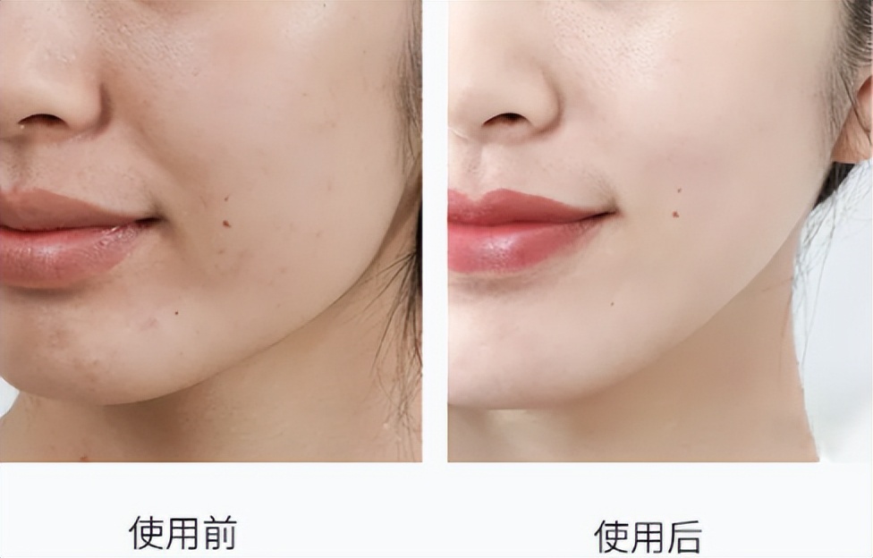 正品新款资生堂悦薇水乳中样套盒,资生堂悦薇水乳2020年双十一