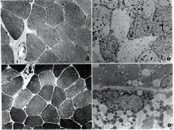 b2对高血压有哪些好处,高血压病人吃维生素b1还是b2