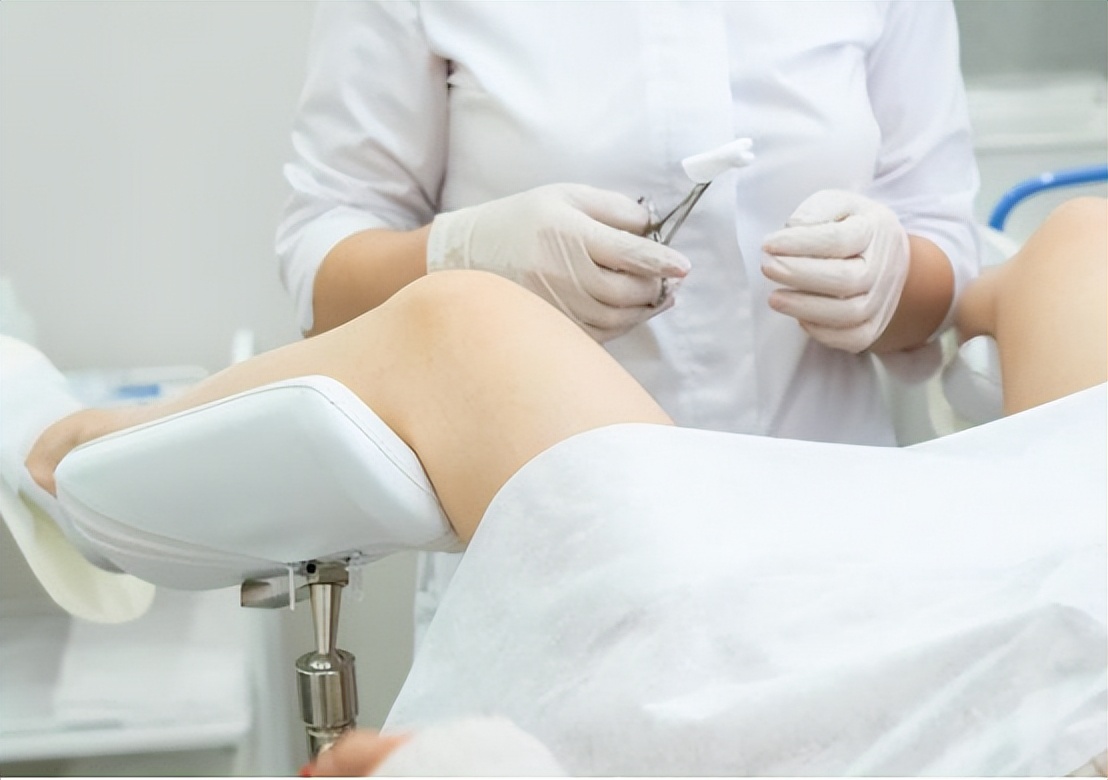 “裤子脱了腿张开”，医院里让人脸红的妇科检查，你做过几个？