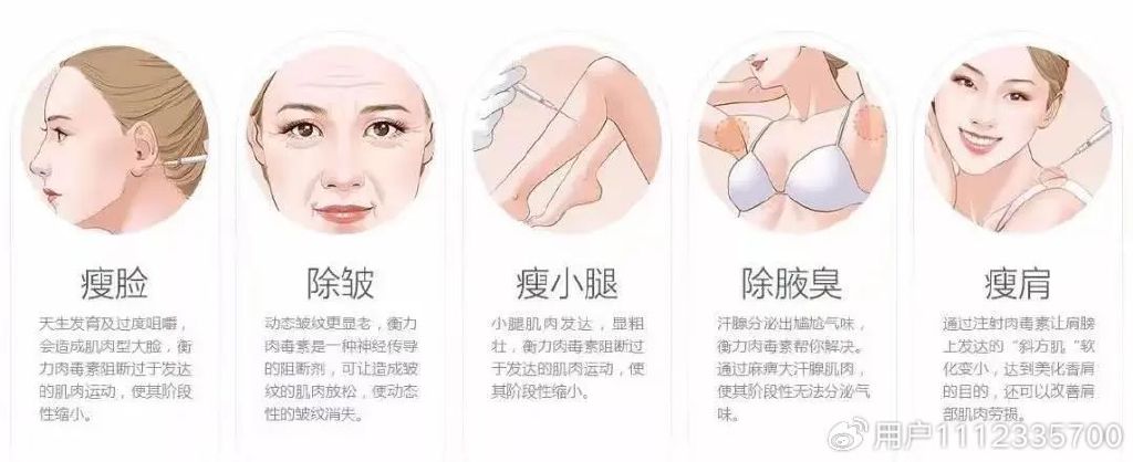 肉毒素注射后的注意事项有哪些,涂抹肉毒素和注射肉毒素