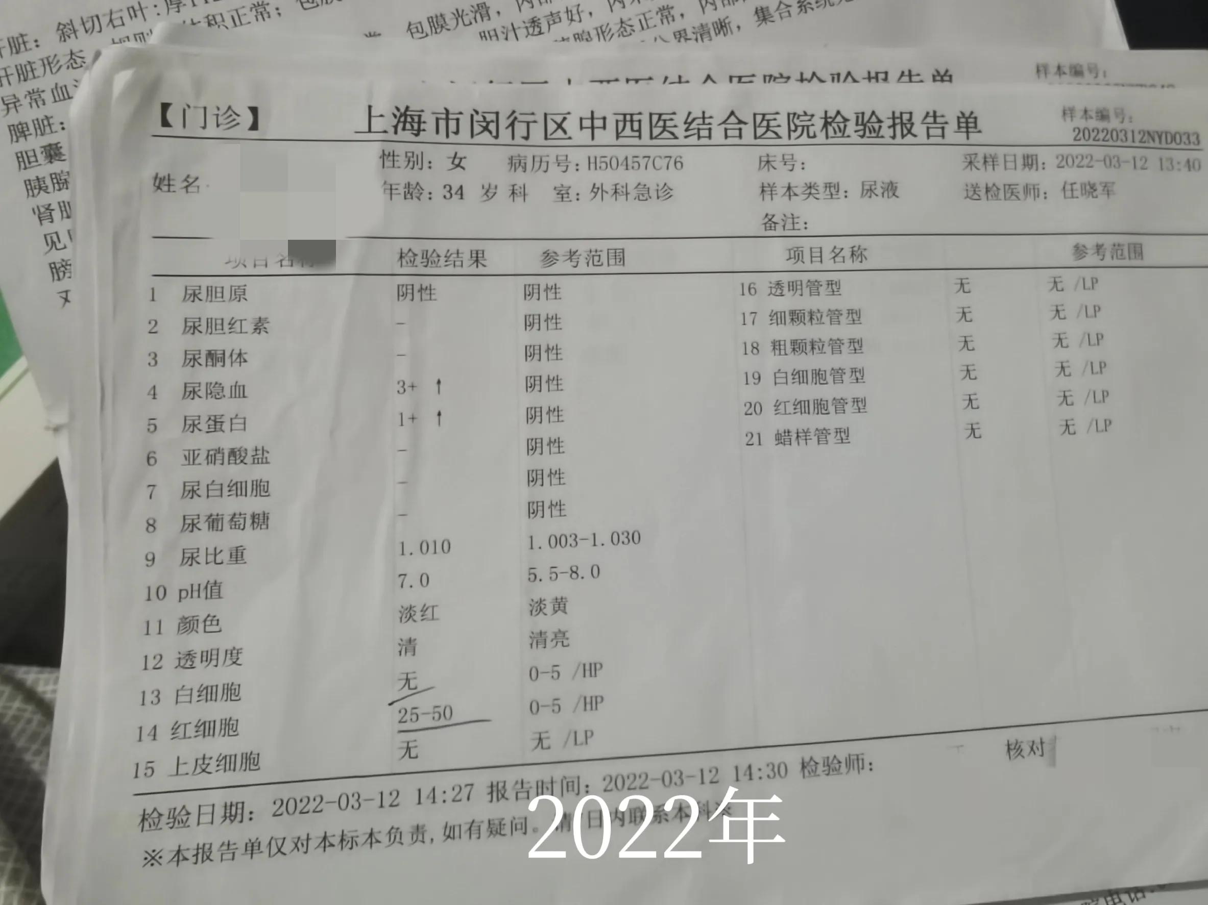 从发现肾炎到治疗，我被医生耽误几年的时间