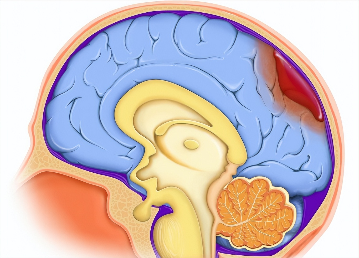 脑外伤后遗症最好的康复方法,治疗脑外伤后遗症最好医院