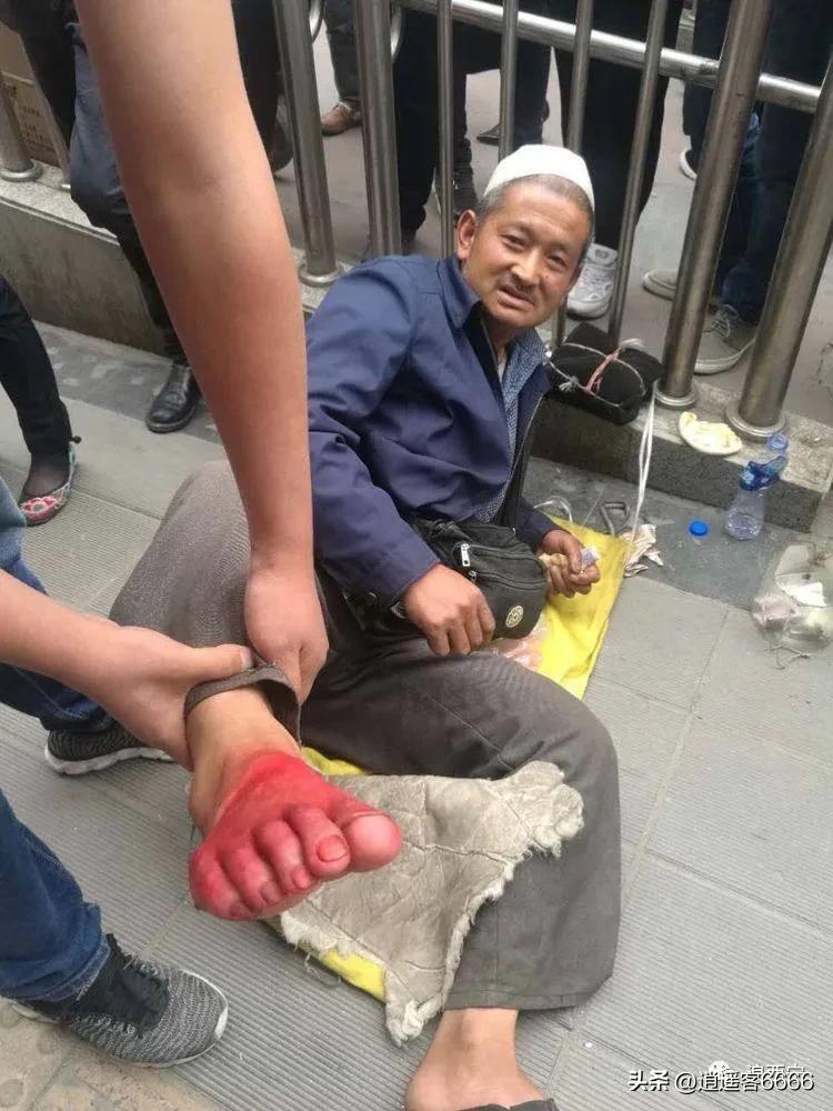 *子骗**手段多，招招见真情，惨不忍睹的假伤