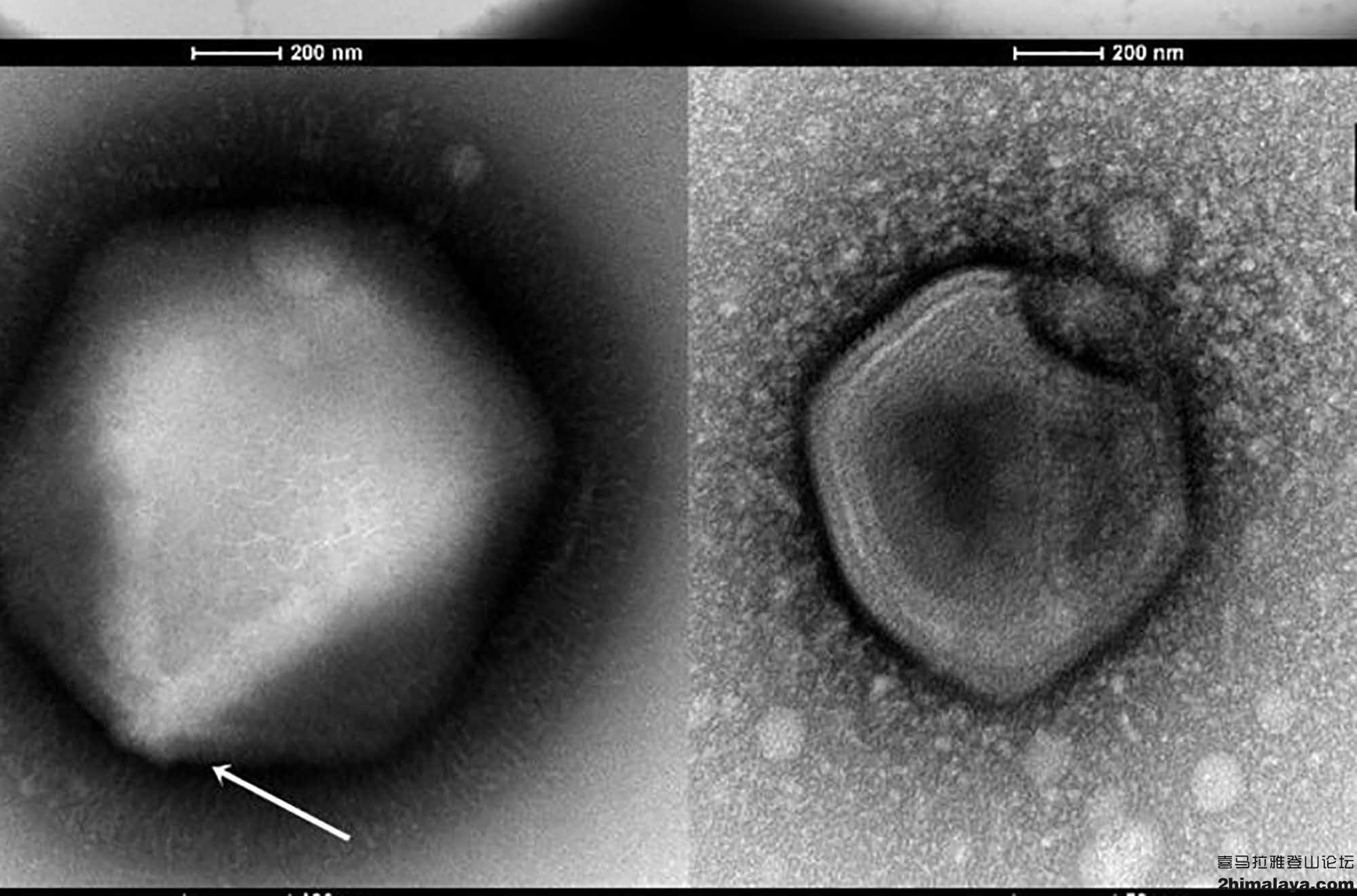 西伯利亚冻土层下面的远古病毒 (俄罗斯感染了僵尸病毒了吗)