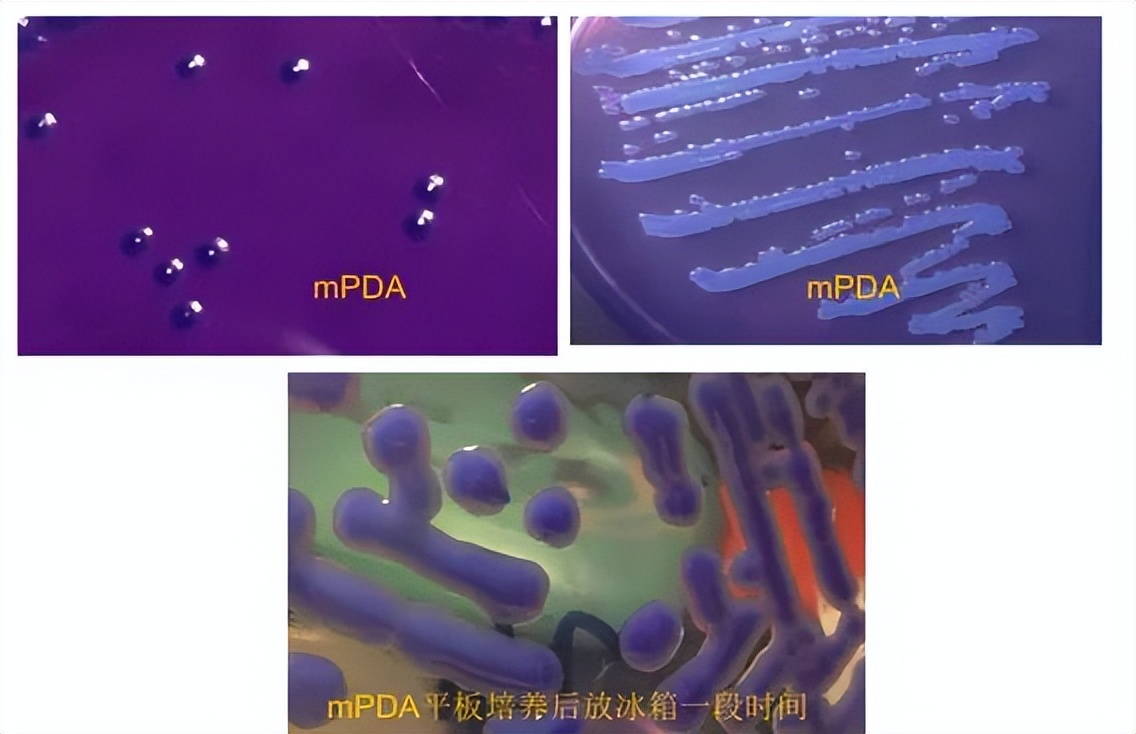 女子吃凉皮中毒是哪家凉皮,吃凉皮中毒会有哪些现状