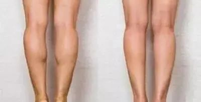 拉筋板真的会瘦肌肉小腿么,拉筋板真的可以瘦哪里