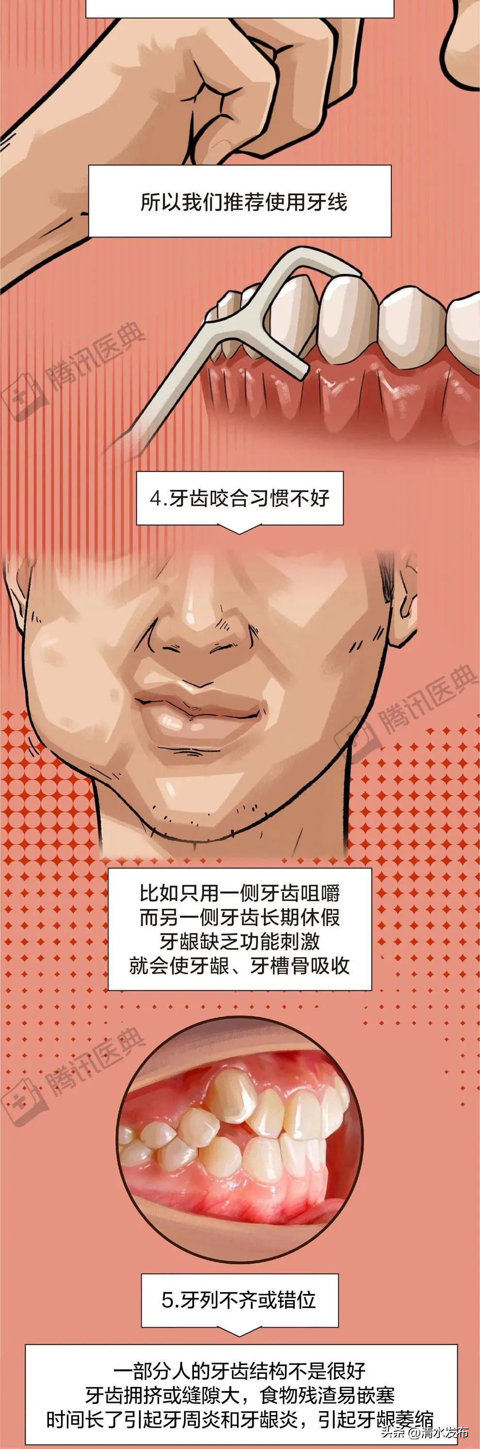 两边大牙一吃肉就塞牙如何修复,14岁学生吃肉老是塞牙需要矫正吗