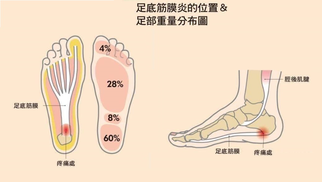 跑步脚痛要不要休息,跑步脚后跟不舒服怎么办